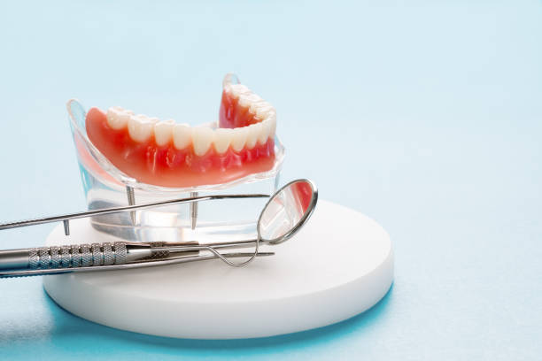 Dental Inlays and Onlays in Luling, TX